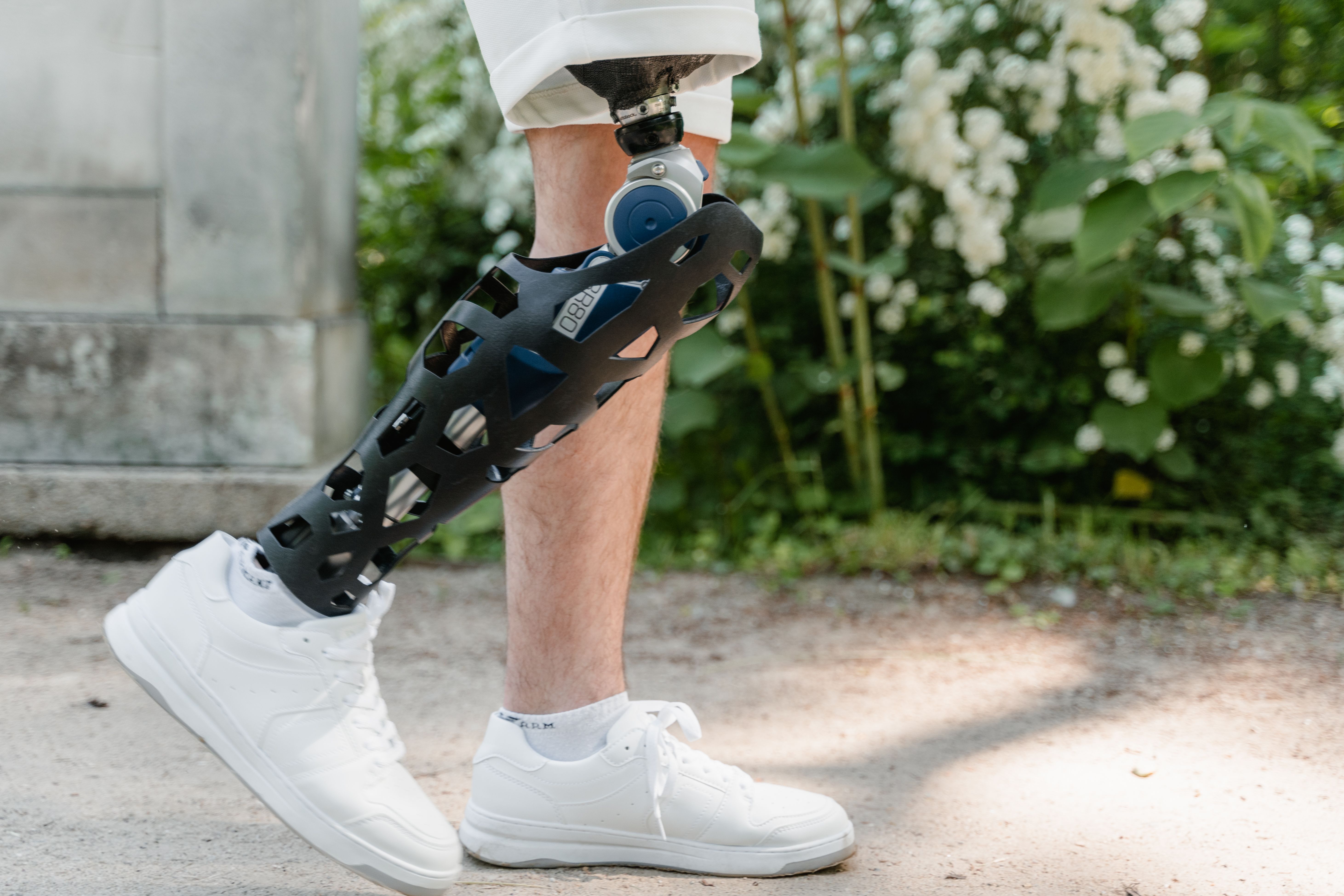Prosthetic consultation at Enduralimb